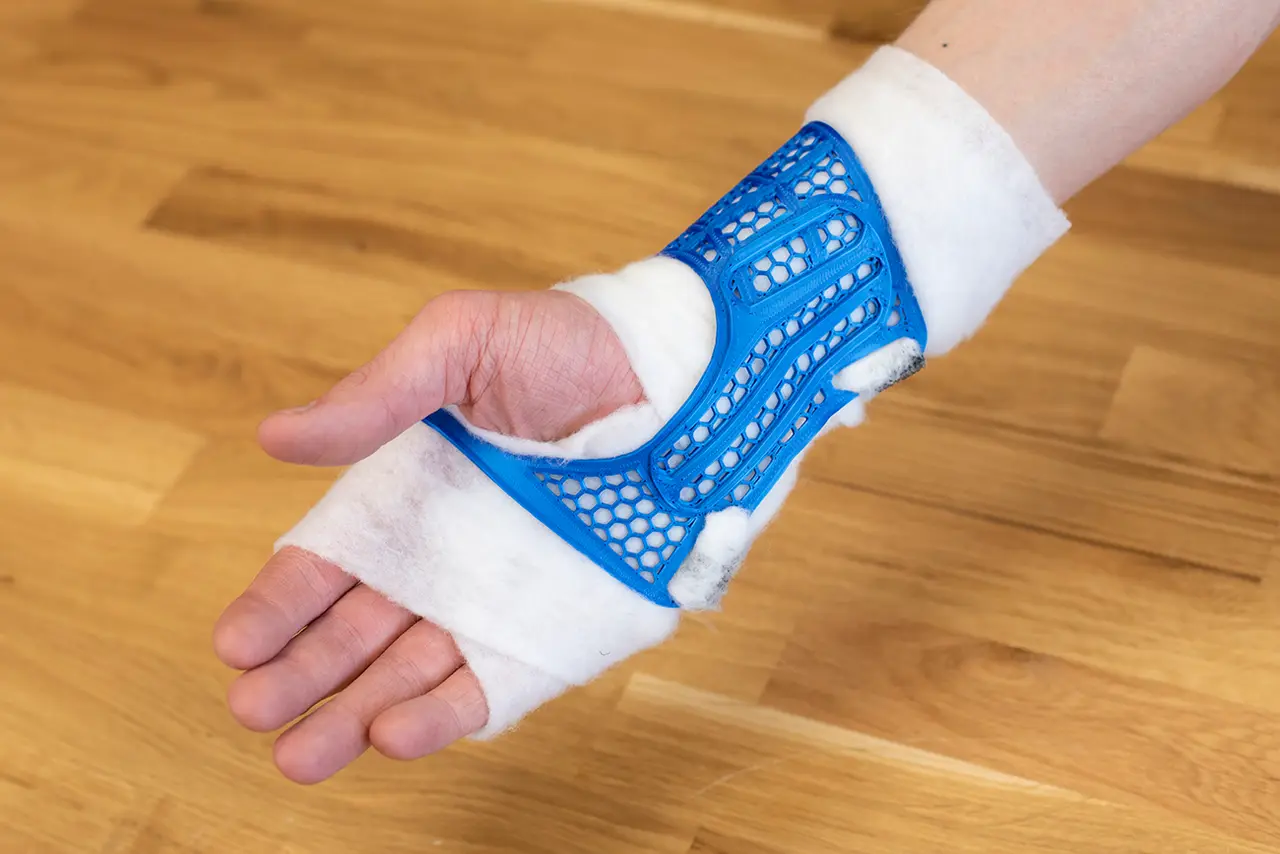 Wrist brace (splint) - a lighter version — modelo 3D
