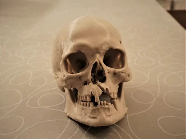 Human Skull with battle injuries (3D scan; Historiska Museet 260727) — modelo 3D