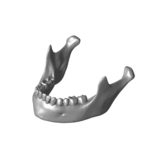 Loose Teeth — modelo 3D